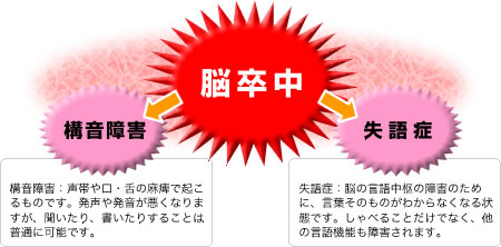 イラスト：脳卒中から構音障害、脳卒中から失語症